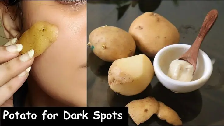 Mix this powder with potato juice to erase all dark spots on your face