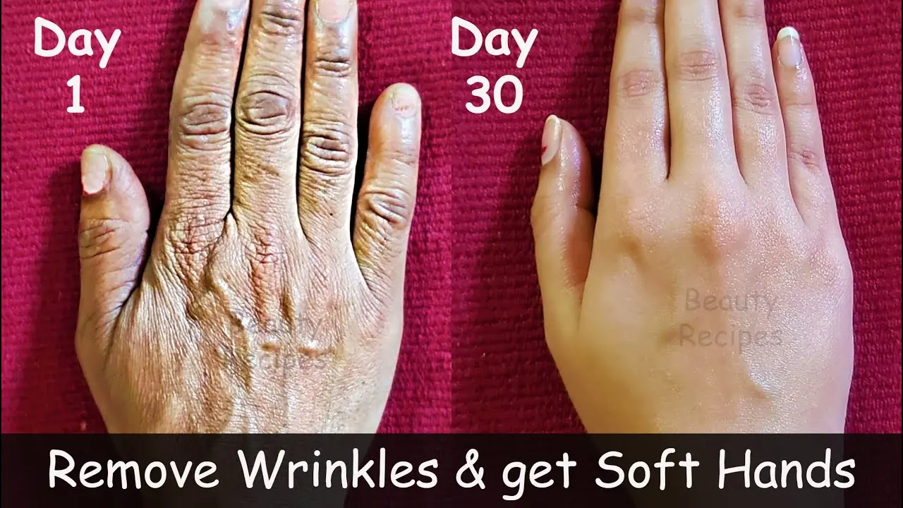 How to Remove Wrinkles from Hands  Wrinkle-Free Hands  Home Remedies