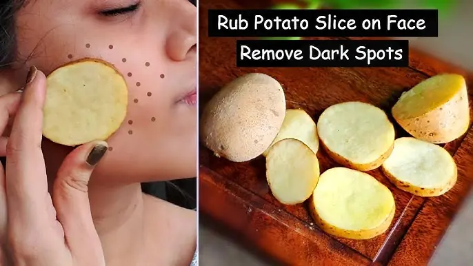 4 Ways to Treat Dark Spots With Potato