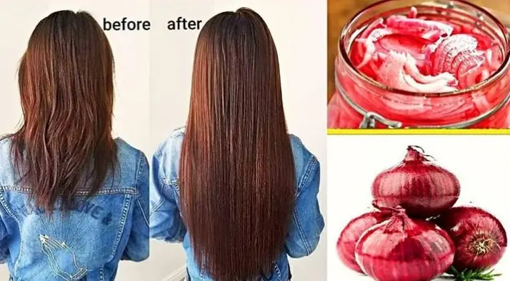 Secret Benefits of Onion Juice for Hair You Didn't Know