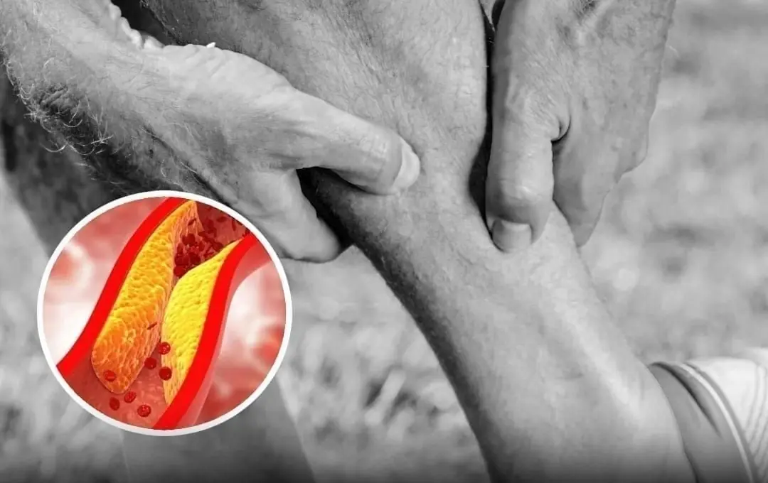 How Your Feet Could Be Signaling Heart Problems and Clogged Arteries