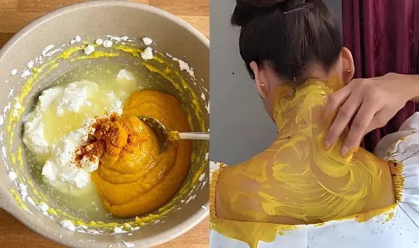 Dark Neck Home Remedies To Get Rid Of It