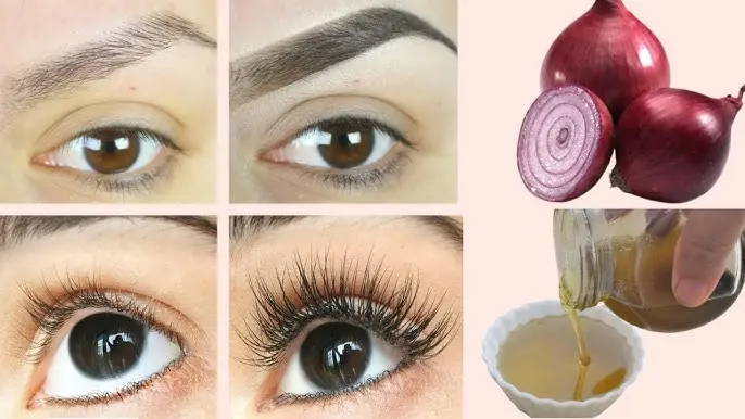 Onion Juice Serum To Grow Thick Eyebrows In Just 1 Week