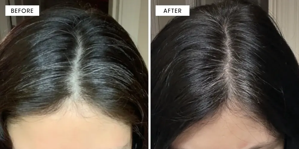 Can You Really Reverse Grey Hair? The Truth Behind Natural Remedies and Modern Treatments
