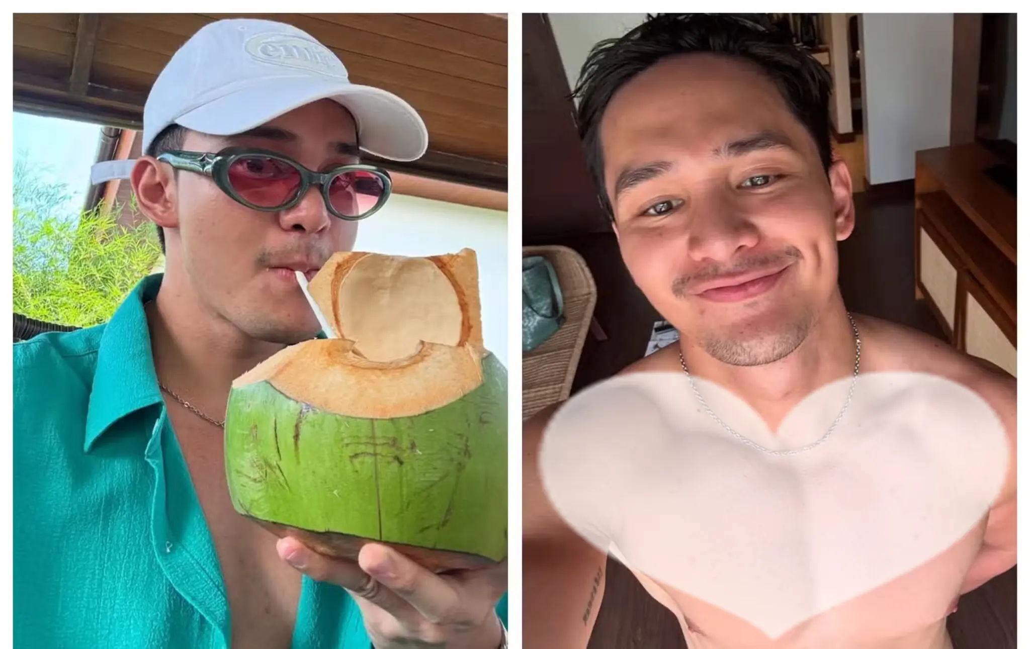 Ruru Madrid’s Unexpected Recovery: Doctor Sh0cked by Actor’s Quick Healing After !njury