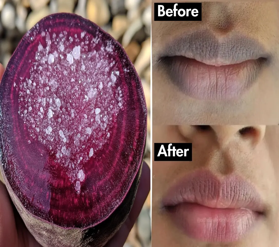 Super Effective DIYs to Achieve Soft, Pink, and Perfect Lips