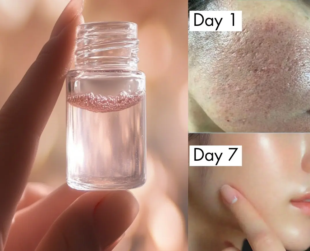 Use This Toner Daily To Get Rid of Large Pores Fast