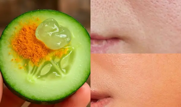 Top 5 Natural Remedies to Shrink Enlarged Pores and Achieve Smooth Skin