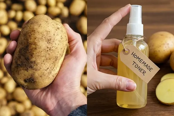 DIY Potato Toner: The Ultimate Solution for Dark Spot Removal and Radiant Skin