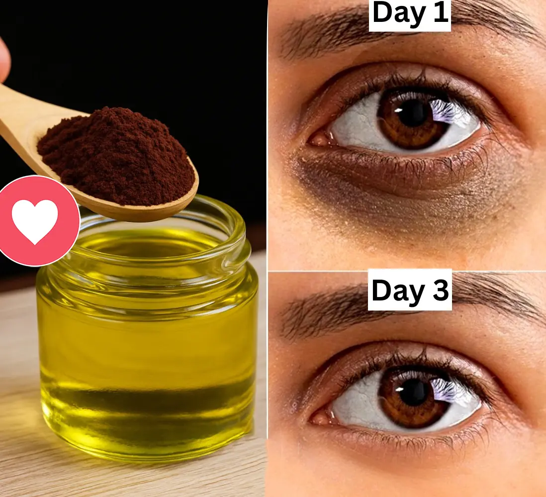 How To Make Under-Eye Coffee Gel To Get Rid Of Puffy Eyes