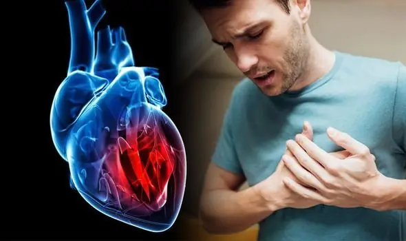 One Month Before a Heart A::::ttack: Recognize These Vital Warning Signs