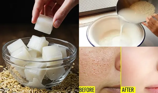 DIY Rice Water Ice Cubes for Clear, Radiant Skin: The Ultimate Natural Remedy to Shrink Large Pores and Glow