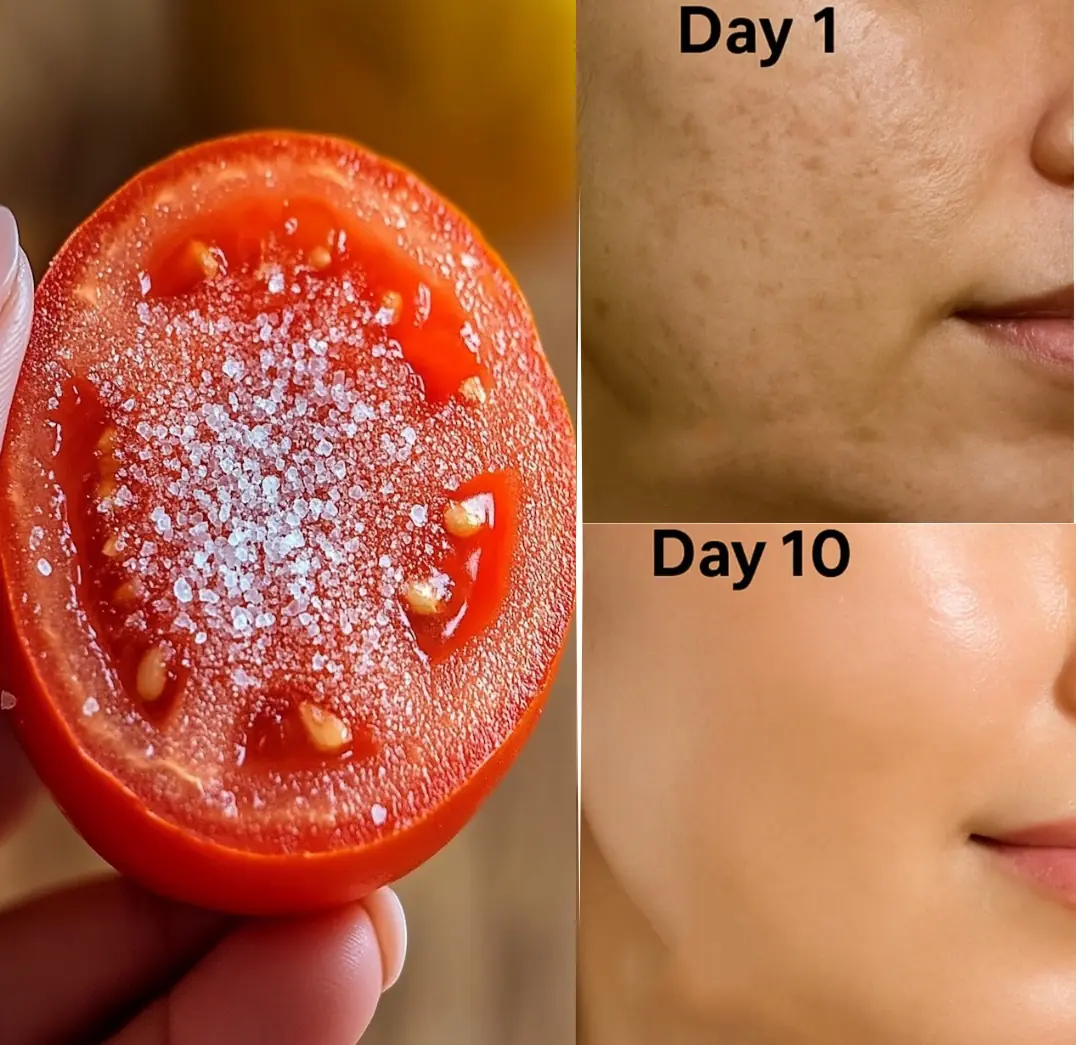 10 Powerful Tomato-Based DIY Face Treatments for Glowing, Clear, and Youthful Skin