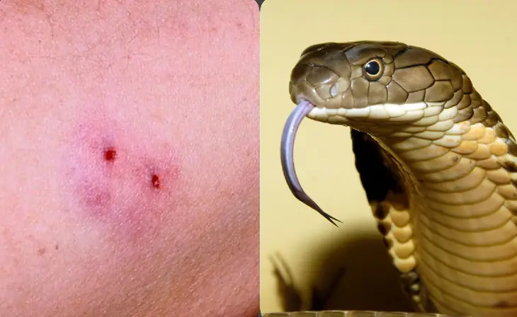 Snakebite Season Is Here: A Comprehensive Guide on How to Respond Safely if B!tten by a Venomous Snake