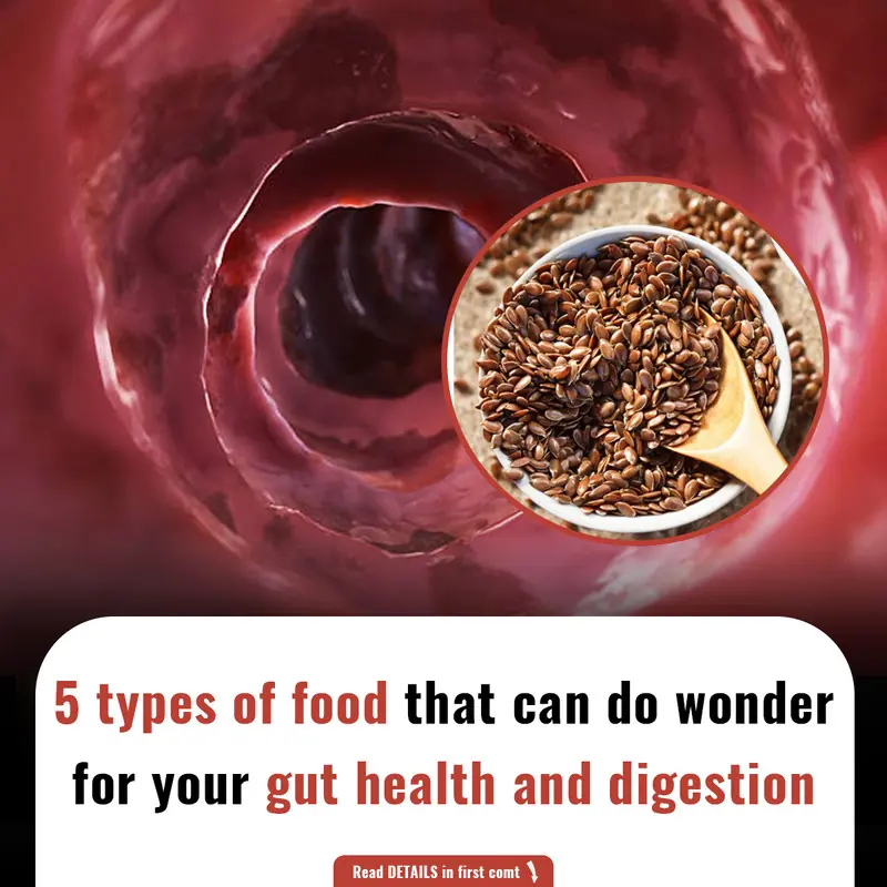 5 types of food that can do wonder for your gut health and digestion