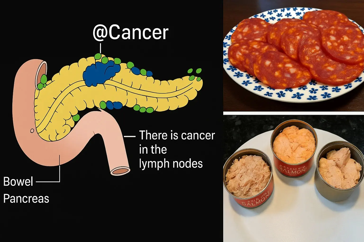 10 Cancer-Linked Foods You Should Never Put in Your Mouth Again