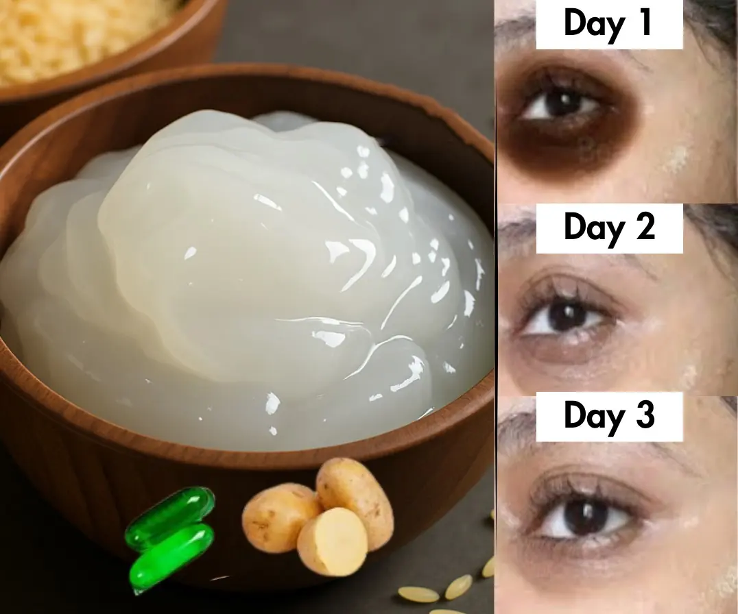 DIY Potato Juice Face Masks and Toners to Get Rid of Dark Circles and Puffiness