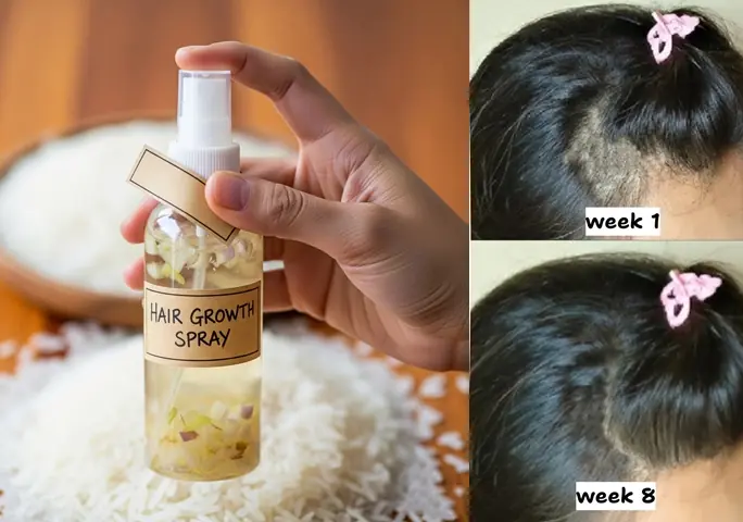 DIY Onion Rice Hair Mask To Boost Hair Growth