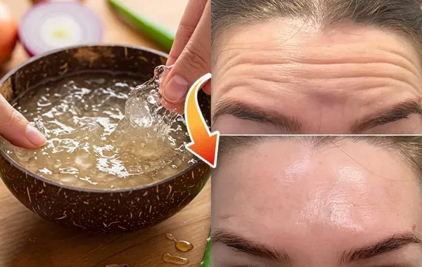 Homemade Aloe Vera Gel to Erase Wrinkles on Your Face: A Natural, DIY Anti-Aging Treatment