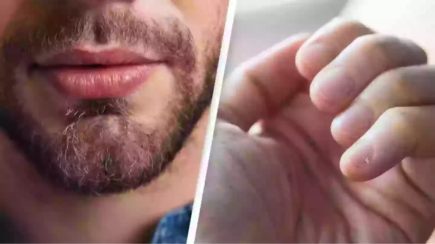 Unusual Skin C@ncer Symptoms: How to Spot Warning Signs on Your Lips and Fingernails