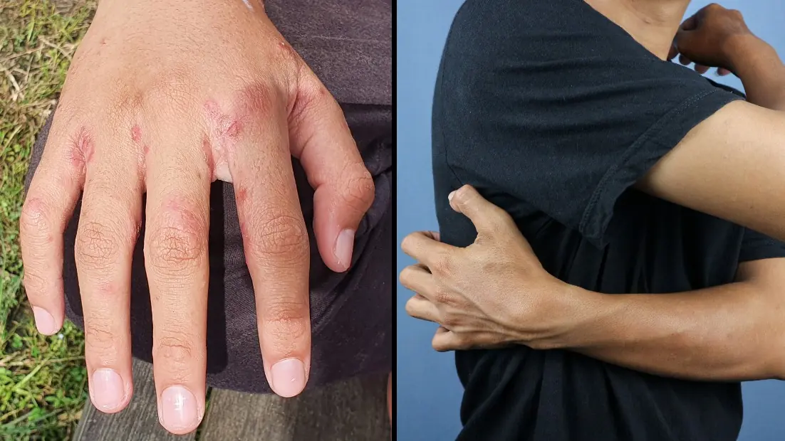 If You Have These Tiny Red Dots On Your Arm, Do Not Ignore The Warning Signs
