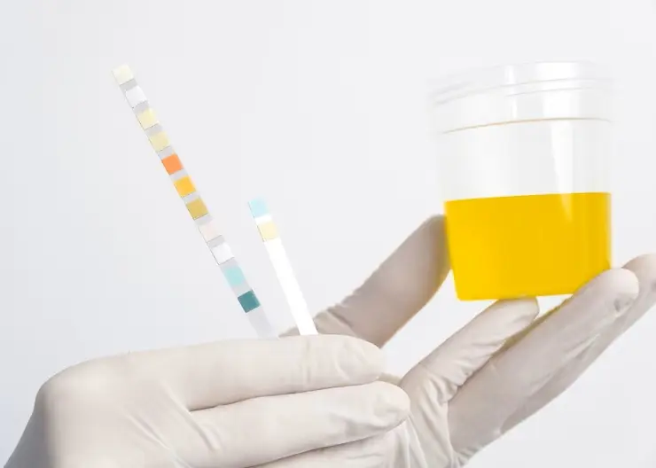 Exploring the Causes of Cloudy Urine: Is Excessive Protein Intake to Blame