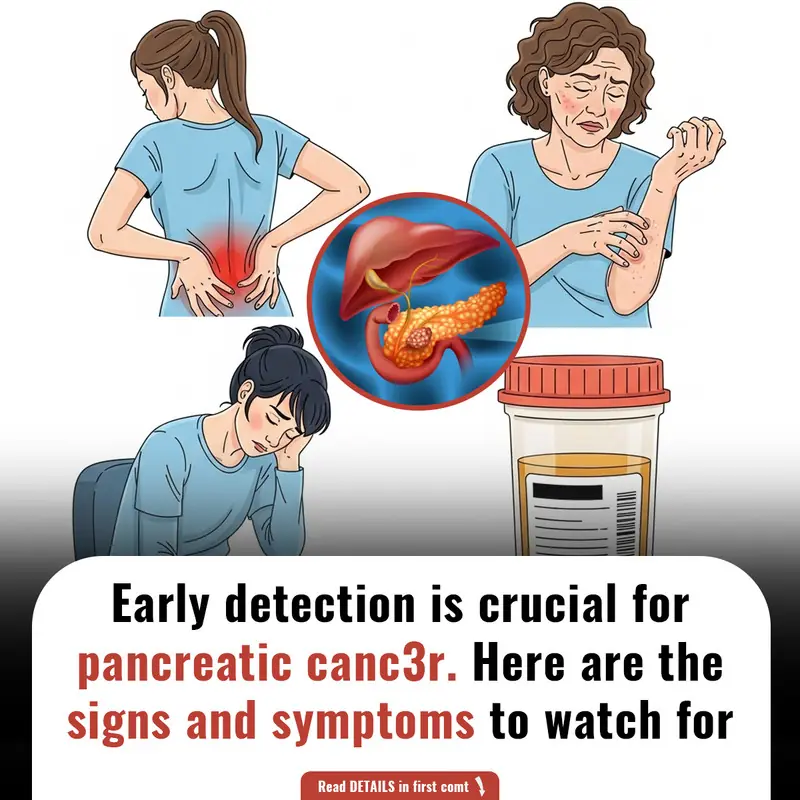 Silent Signals: Recognizing the Subtle Symptoms of Pancreatic C@ncer