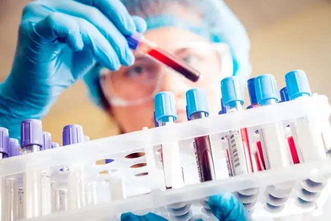 Important Tips Before Taking a Bl00d Test for the Most Accurate Results