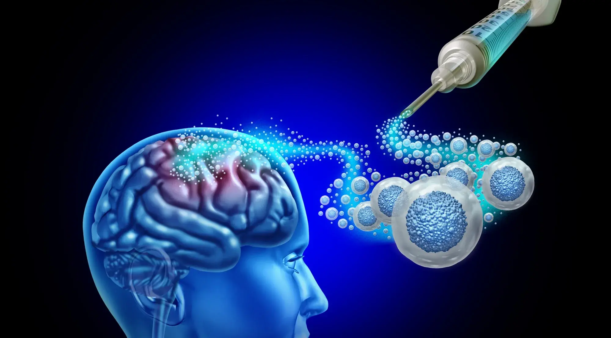 Parkinson’s Breakthrough: Japan's Stem Cell Treatment Restores Brain Function Without Side Effects