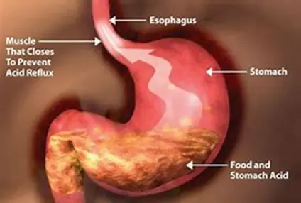 Your Stomach Ac!d Could Digest Razor Blades - Here's How You Don't D!e From It