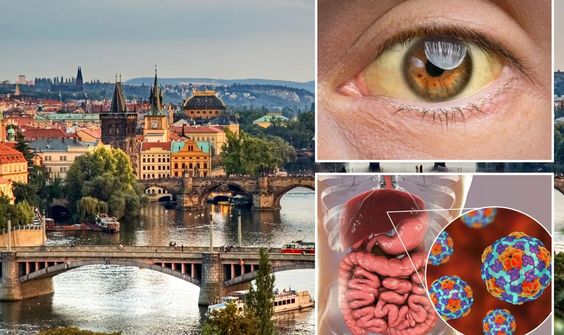 Urgent warning over worrying surge in killer virus in four holiday hotspots - bug can cause liver failure