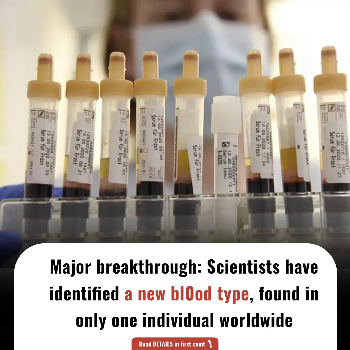 Major breakthrough: Scientists have identified a new bl0od type, found in only one individual worldwide