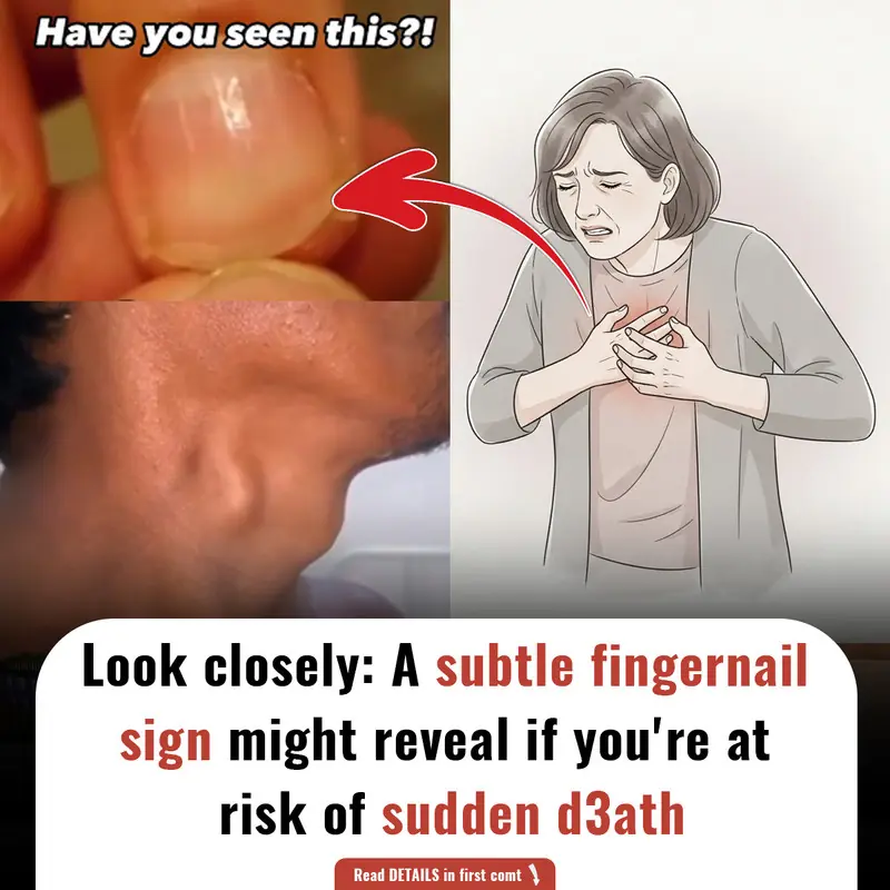 Look closely: A subtle fingernail sign might reveal if you're at risk of sudden d3ath