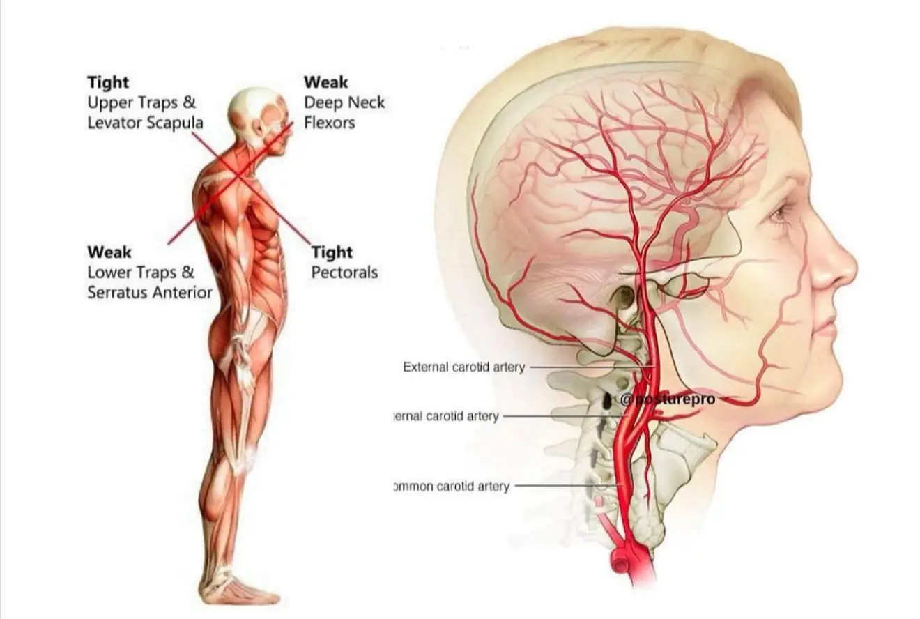 The Impact of Forward Head Posture on Brain Health and Bl00d Flow
