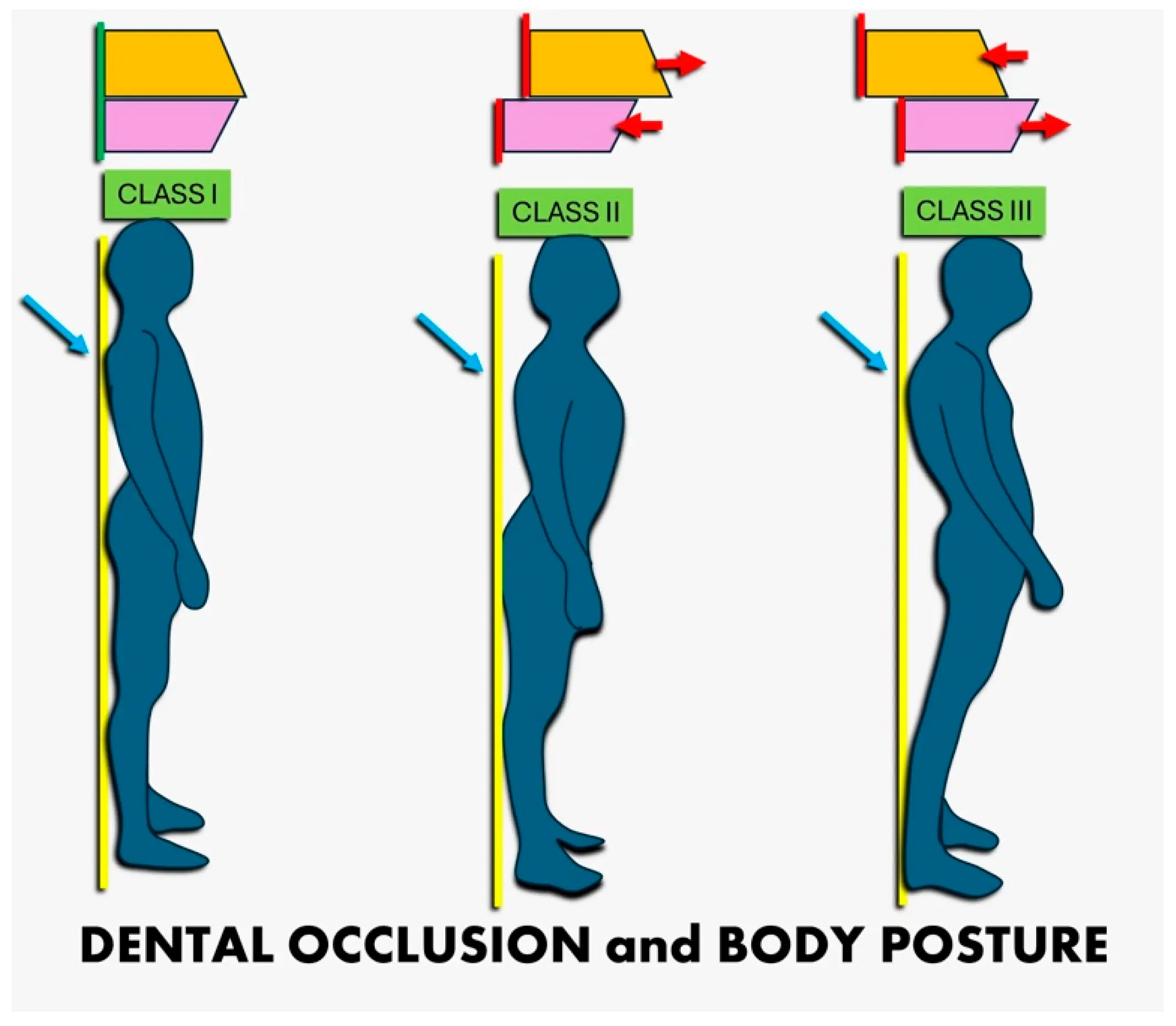 How Jaw Position Affects Posture: The Surprising Connection Between Jaw Alignment and Body Posture