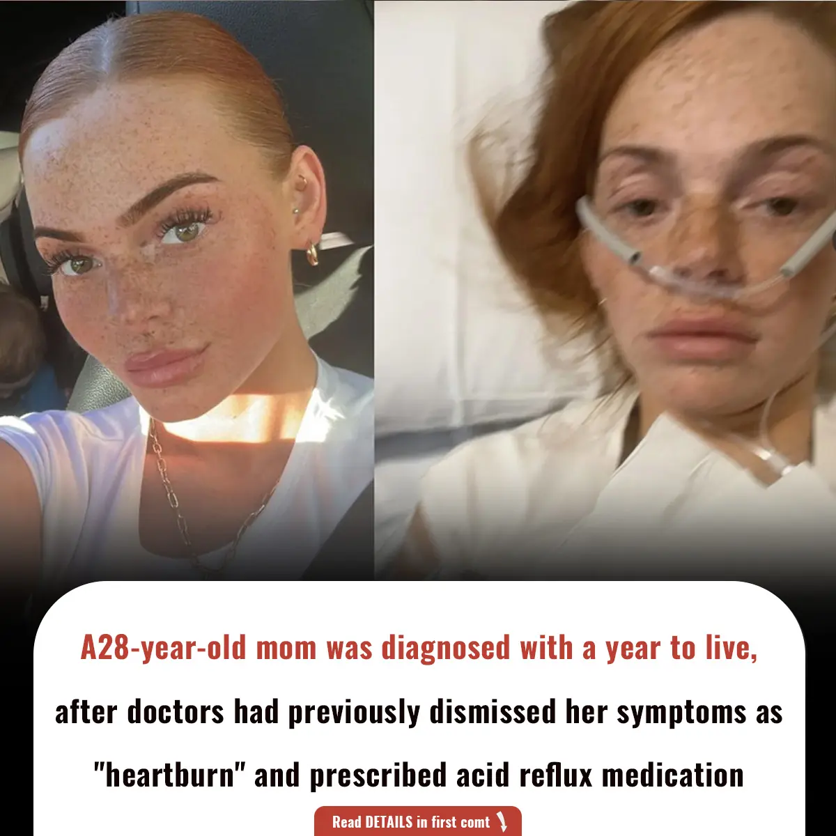 A28-year-old mom was diagnosed with a year to live, after doctors had previously dismissed her symptoms as "heartburn" and prescribed acid reflux medication
