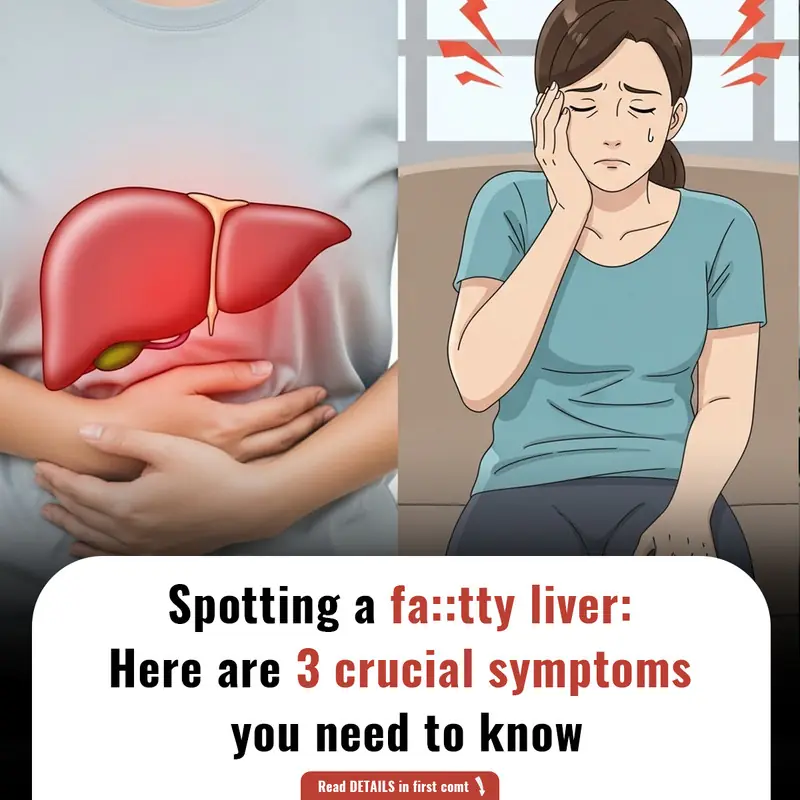 Spotting a fatty liver: Here are 3 crucial symptoms you need to know