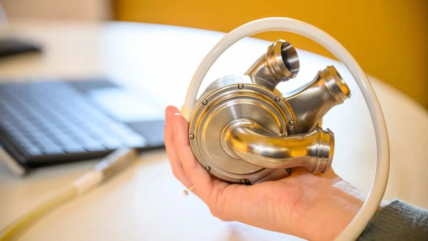 Breakthrough in Heart Health: World’s First Person to Live 100+ Days with Artificial Heart