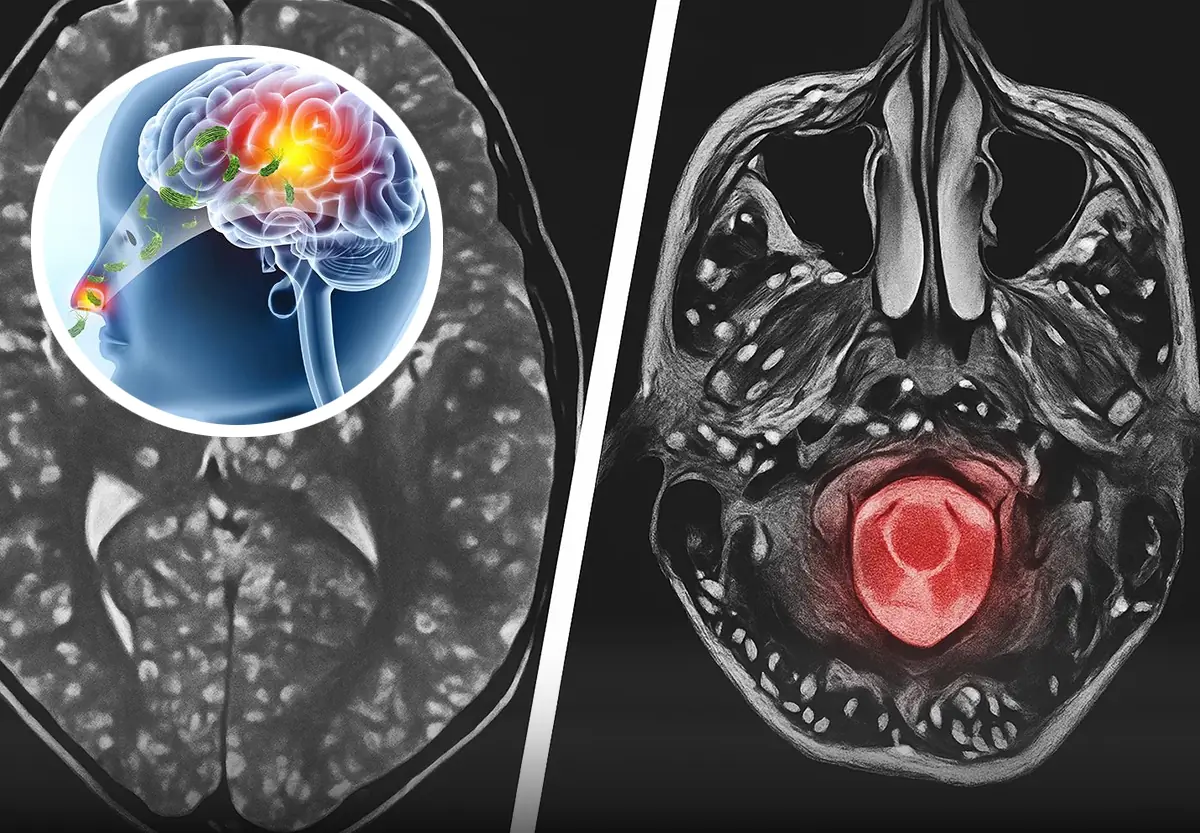 Terrifying study finds 30% of Americans could be infected with parasite that has horrific impact on brains