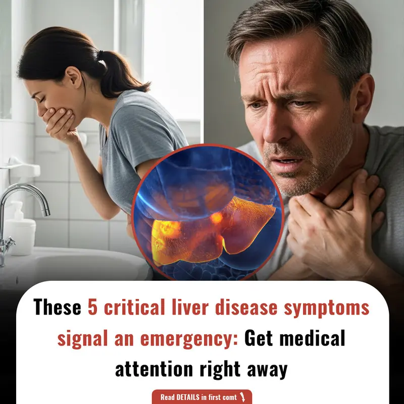 These 5 critical liver disease symptoms signal an emergency: Get medical attention right away