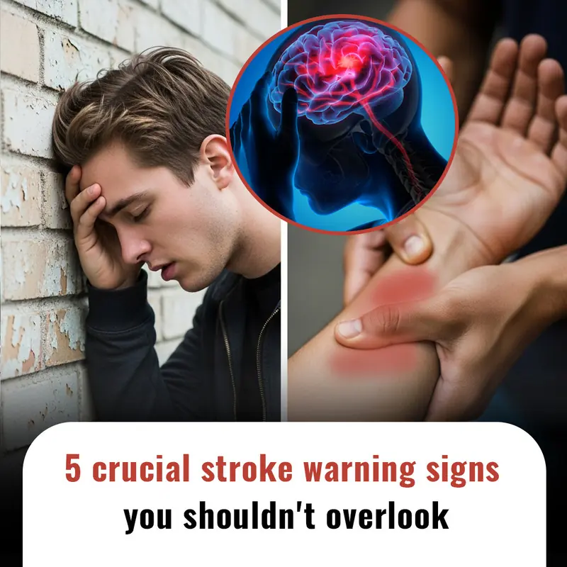 5 crucial stroke warning signs you shouldn't overlook