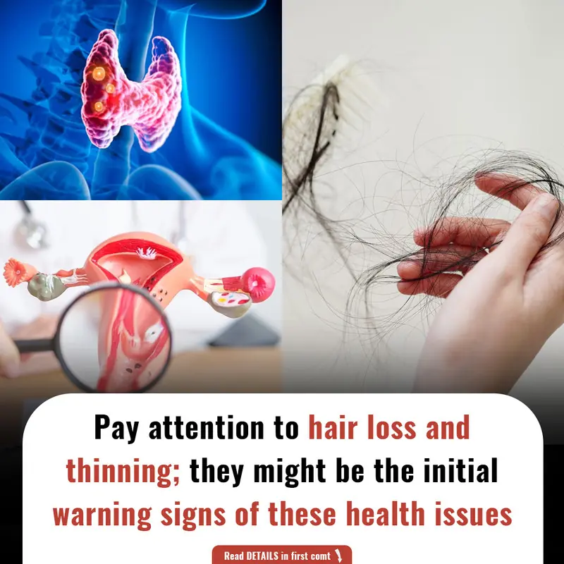 Pay attention to hair loss and thinning; they might be the initial warning signs of these health issues