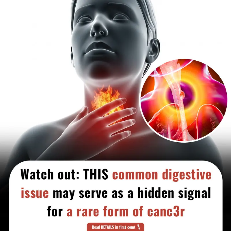 Watch out: THIS COMMON digestive issue may serve as a hidden signal for a rare form of canc3r