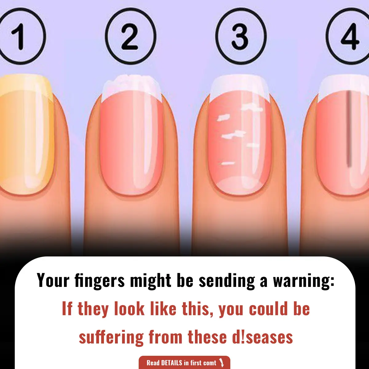 Your fingers might be sending a warning: If they look like this, you could be suffering from these d!seases