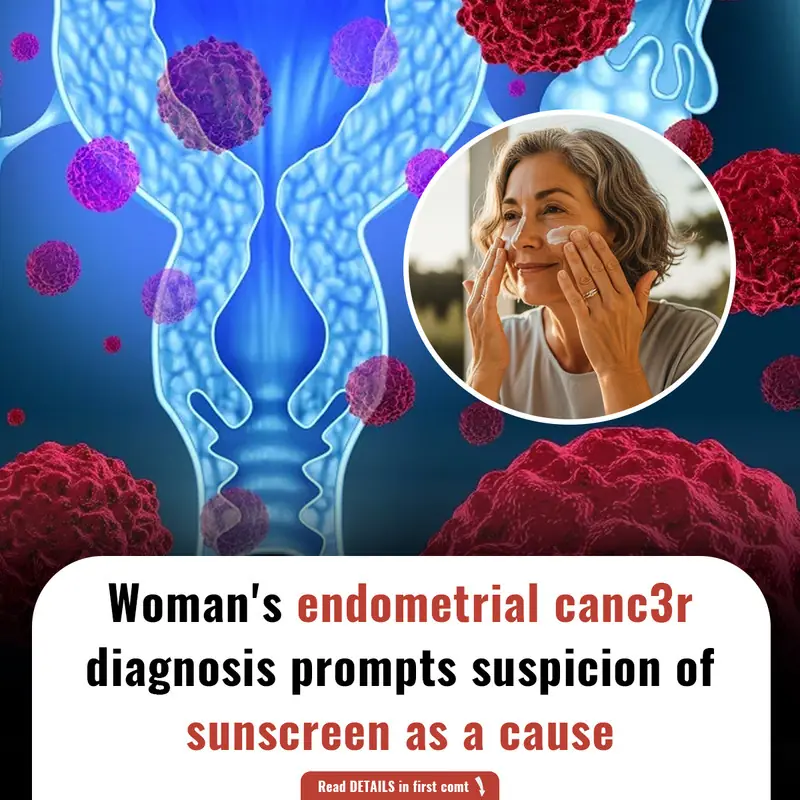 Woman's endometrial canc3r diagnosis prompts suspicion of sunscreen as a cause