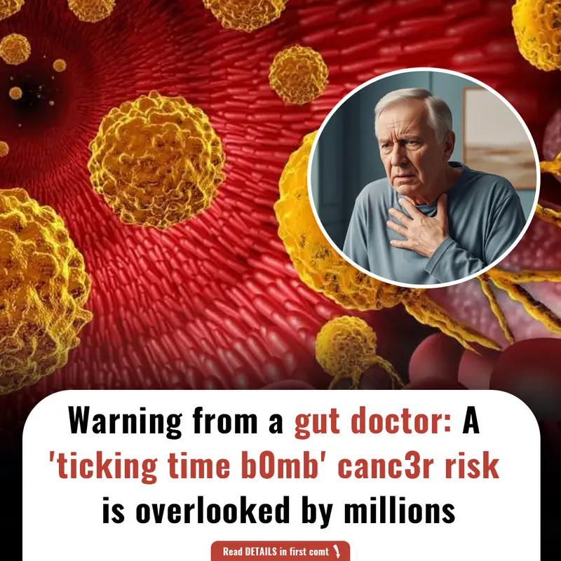 Warning from a gut doctor: A 'ticking time b0mb' canc3r risk is overlooked by millions