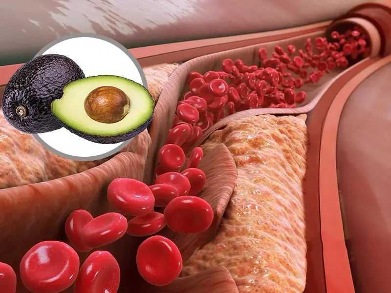 5 golden foods that help lower blood fat effectively but not everyone knows