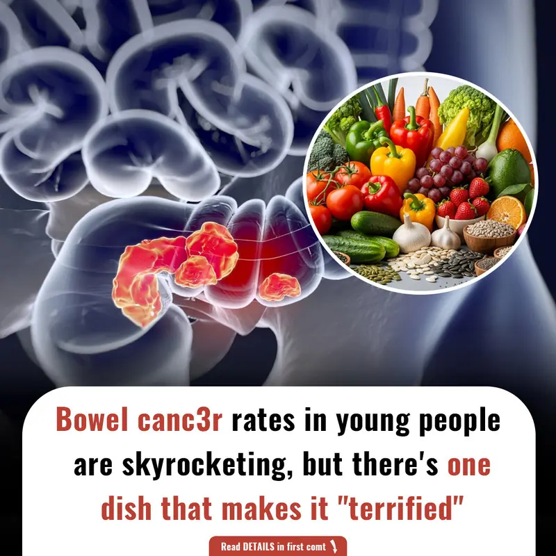 Bowel canc3r rates in young people are skyrocketing, but there's one dish that makes it "terrified"
