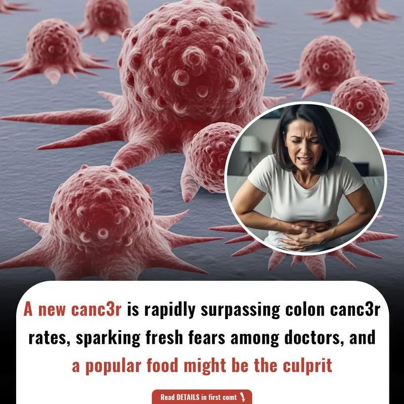 A new canc3r is rapidly surpassing colon canc3r rates, sparking fresh fears among doctors—and a popular food might be the culprit