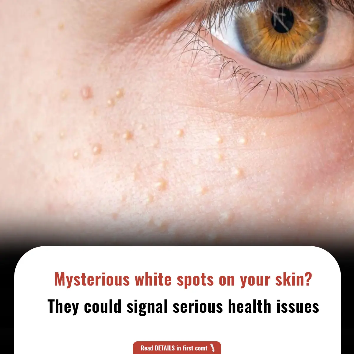 Mysterious white spots on your skin? They could signal serious health issues